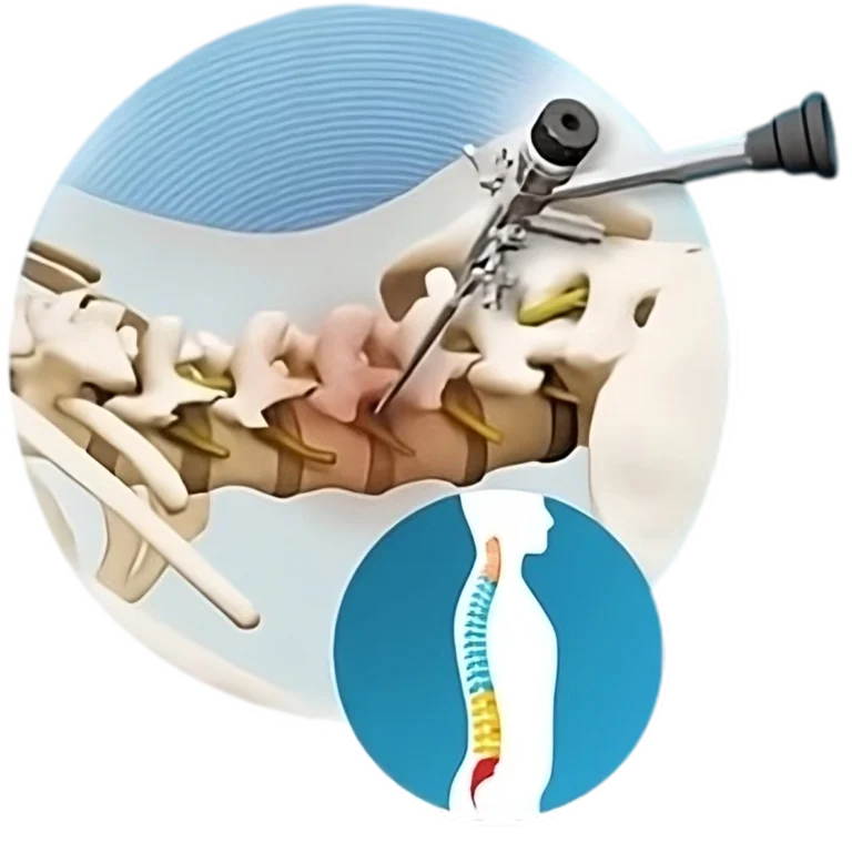 Ativo-7-296x300-transformed