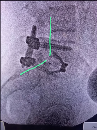 Opera Instantâneo_2024-08-15_163444_www.instagram.com